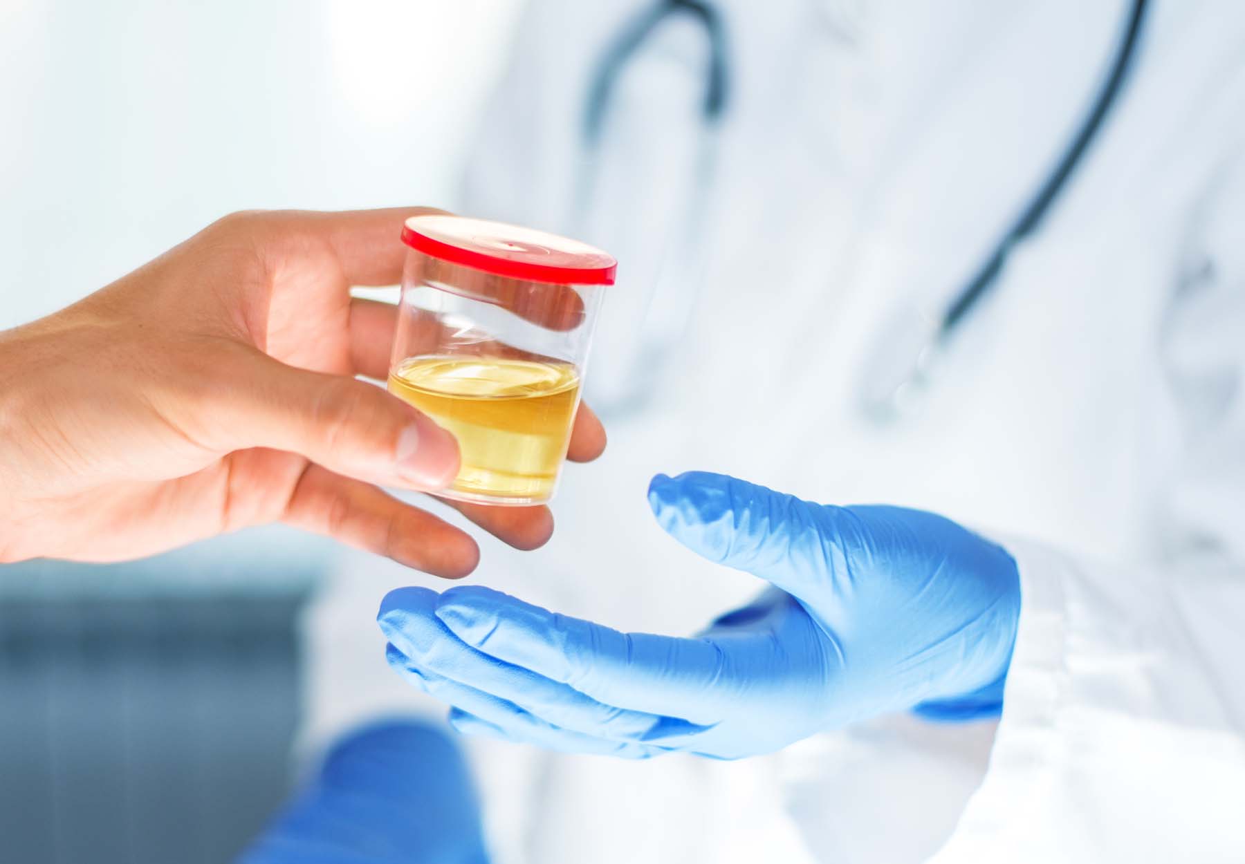 A patient hands a urine sample to a physician.