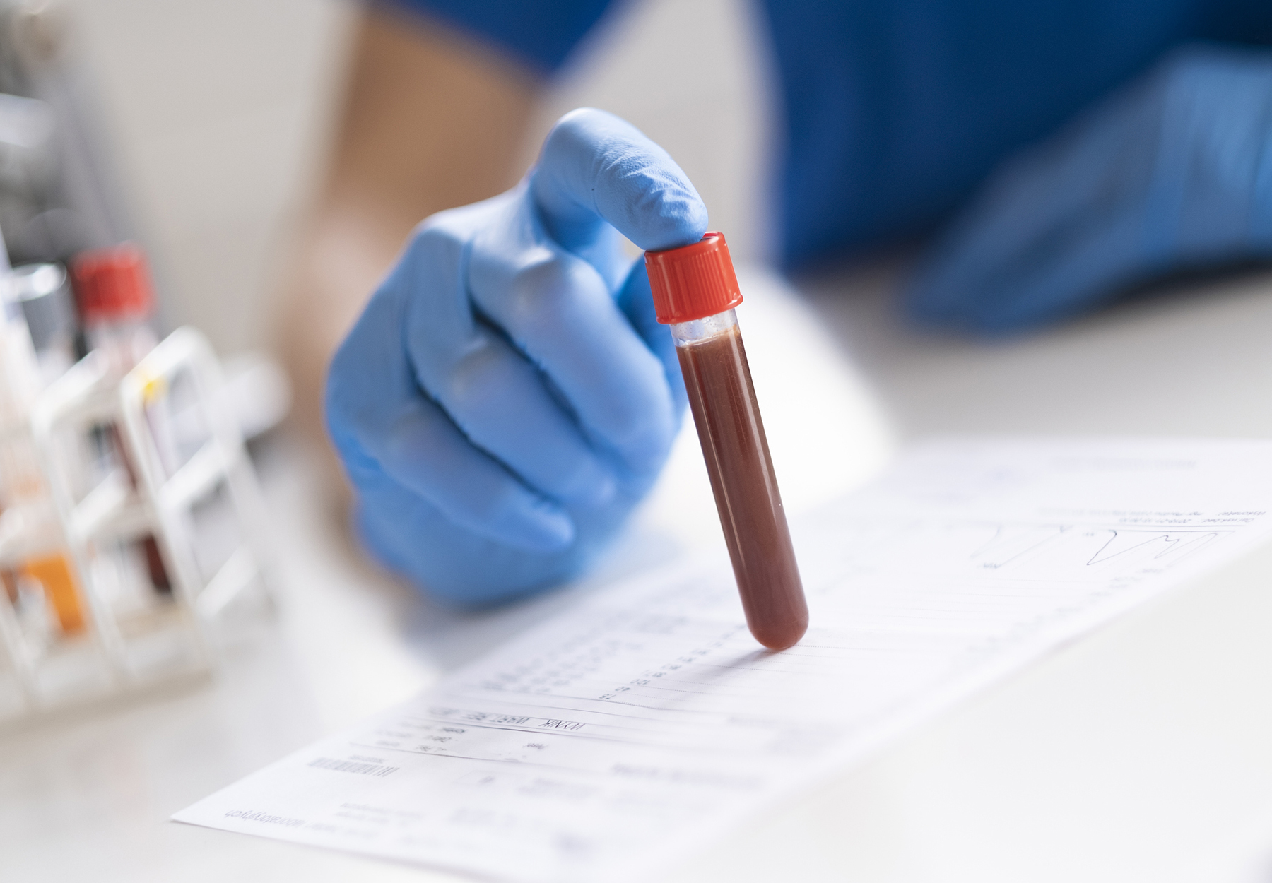 A closeup of a blood sample held by a gloved health care worker.