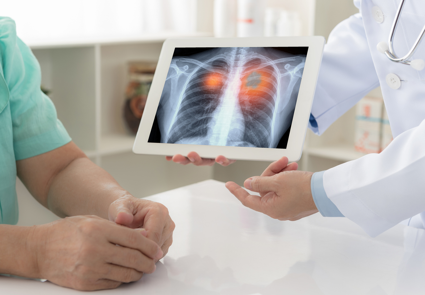 Closeup of doctor holding tablet with image of lungs up to patient to illustrate the concept of lung cancer screening.
