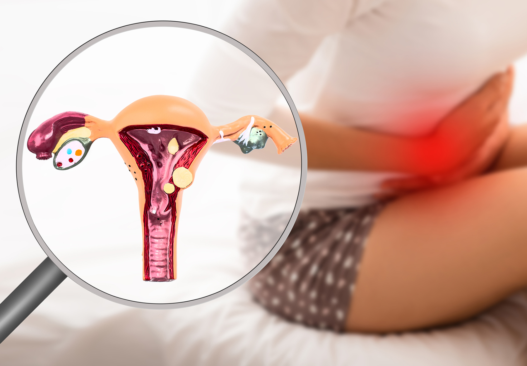 Endometriosis, virtual model of the uterus, close-up. Woman suffering from menstrual pain, while sitting on bed.
