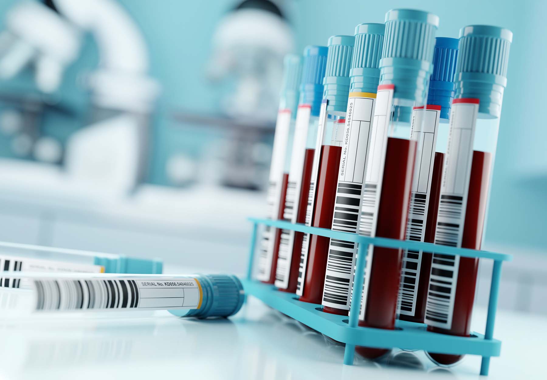 Closeup of blood samples in a rack.