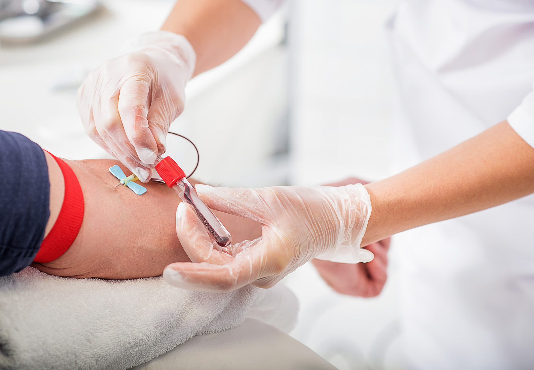 A closeup of a nurse taking a blood sample from a patient's arm.