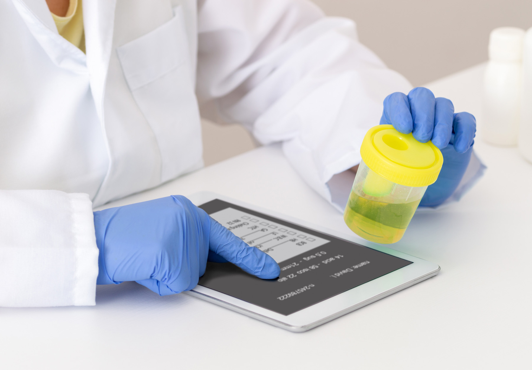 A closeup of medical professional holding a urine sample while typing on a tablet