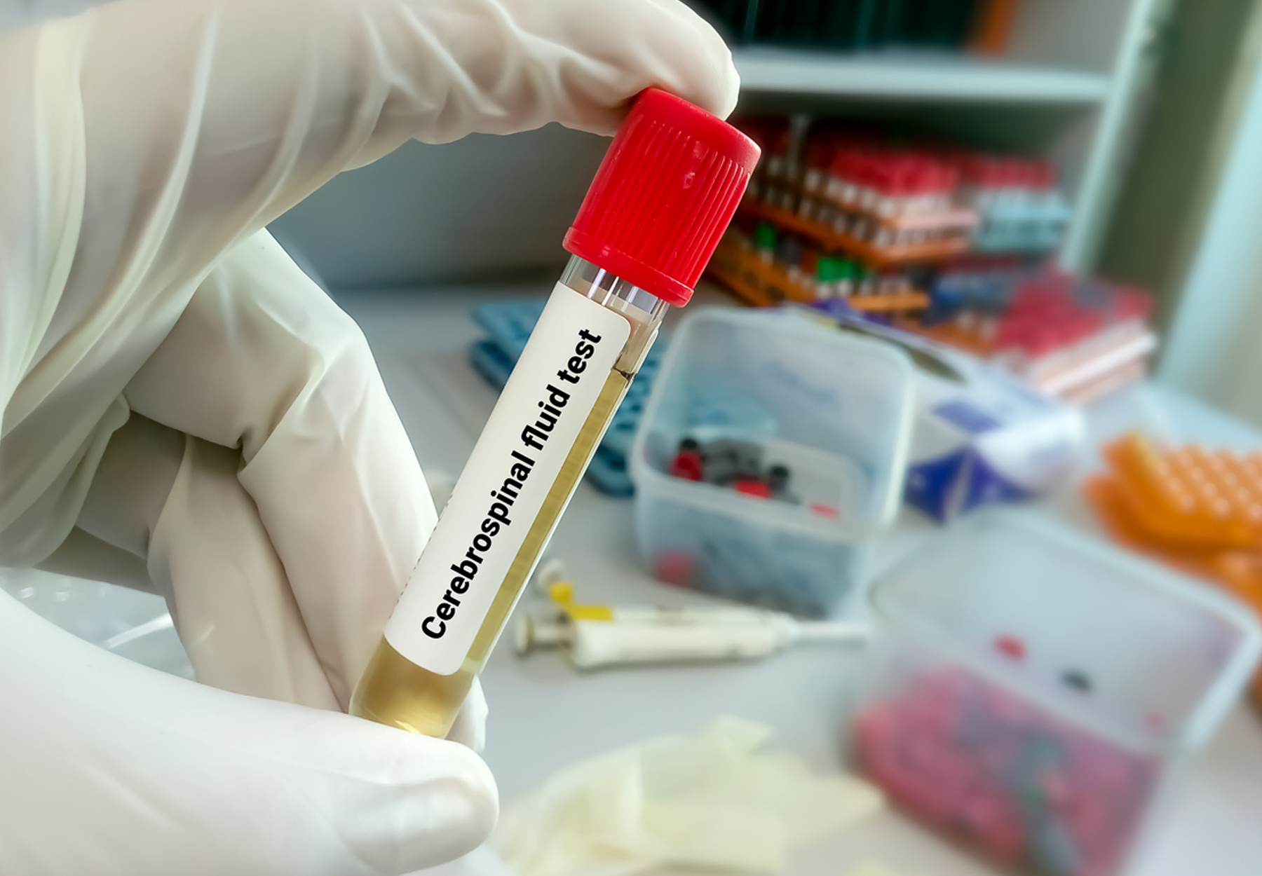 A closeup of a hand holding a vial of CSF