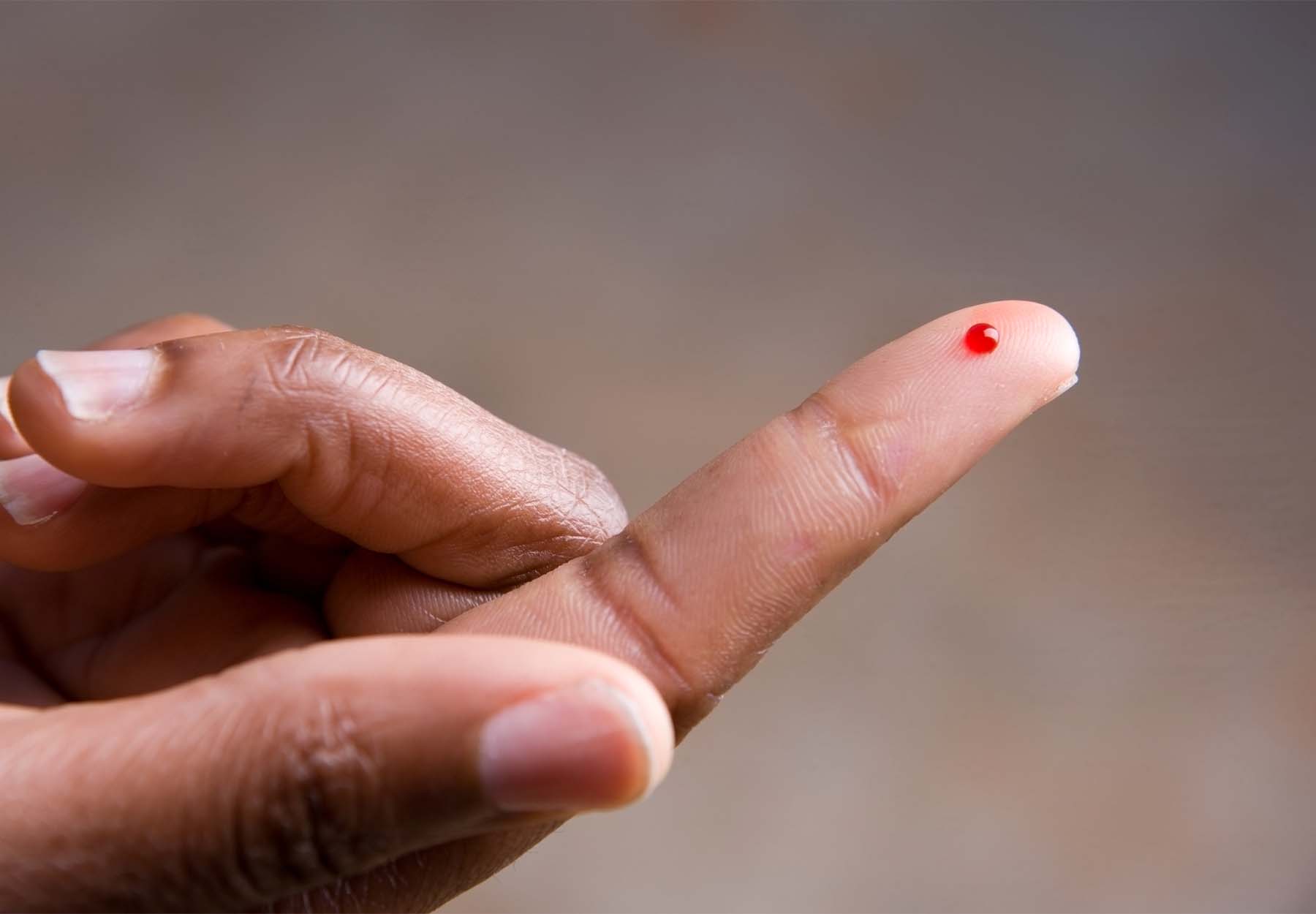 Blood on a finger to show the concept of a bloodstick test.