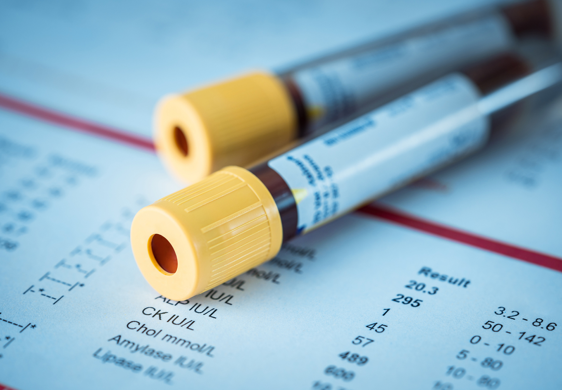 Blood test tubes stock photo