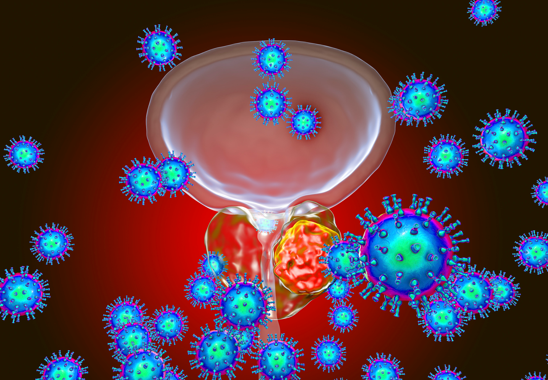 Conceptual image for viral ethiology of prostate cancer