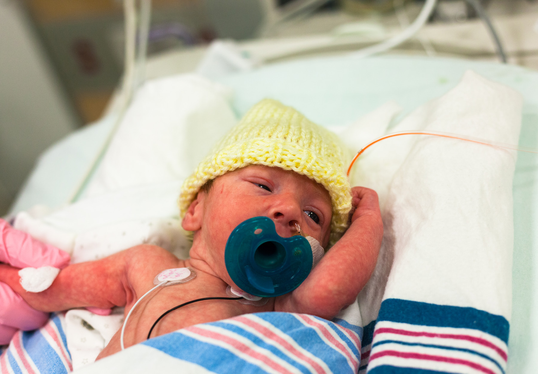 Premature baby in the neonatal intensive care unit with a pacifier stock photo