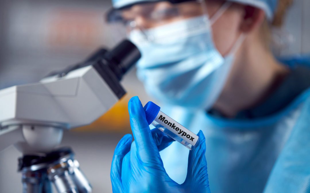 Becton Dickinson, Cepheid Unveil Monkeypox PCR Test Collaborations