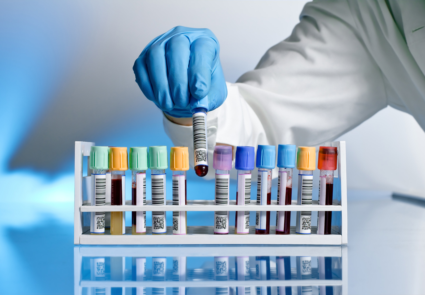 Stock image of lab worker removing a tube of blood from a rack of blood sample tubes.