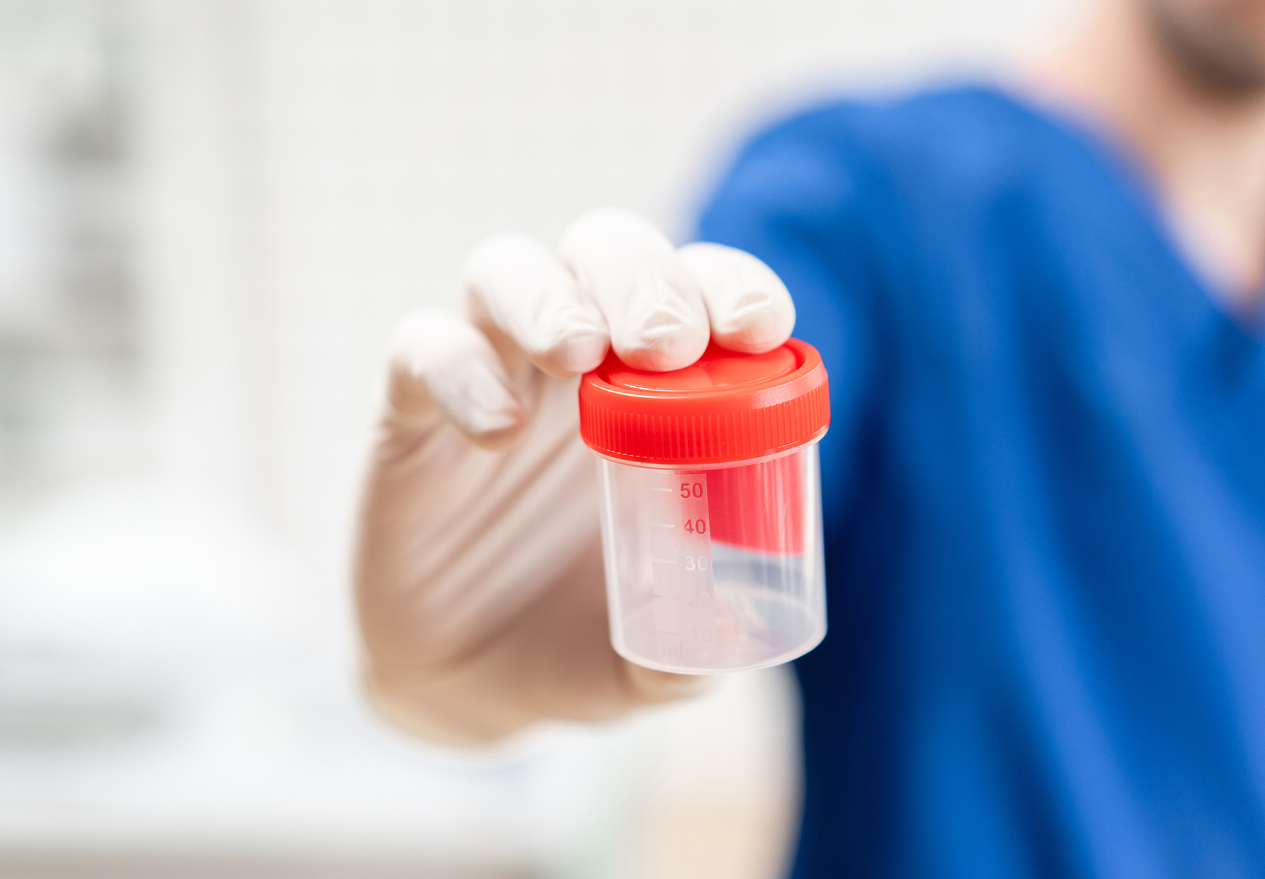 Doctor in blue uniform and latex gloves is holding an empty plastic container for taking urine samples, light background. Medical concept. stock photo