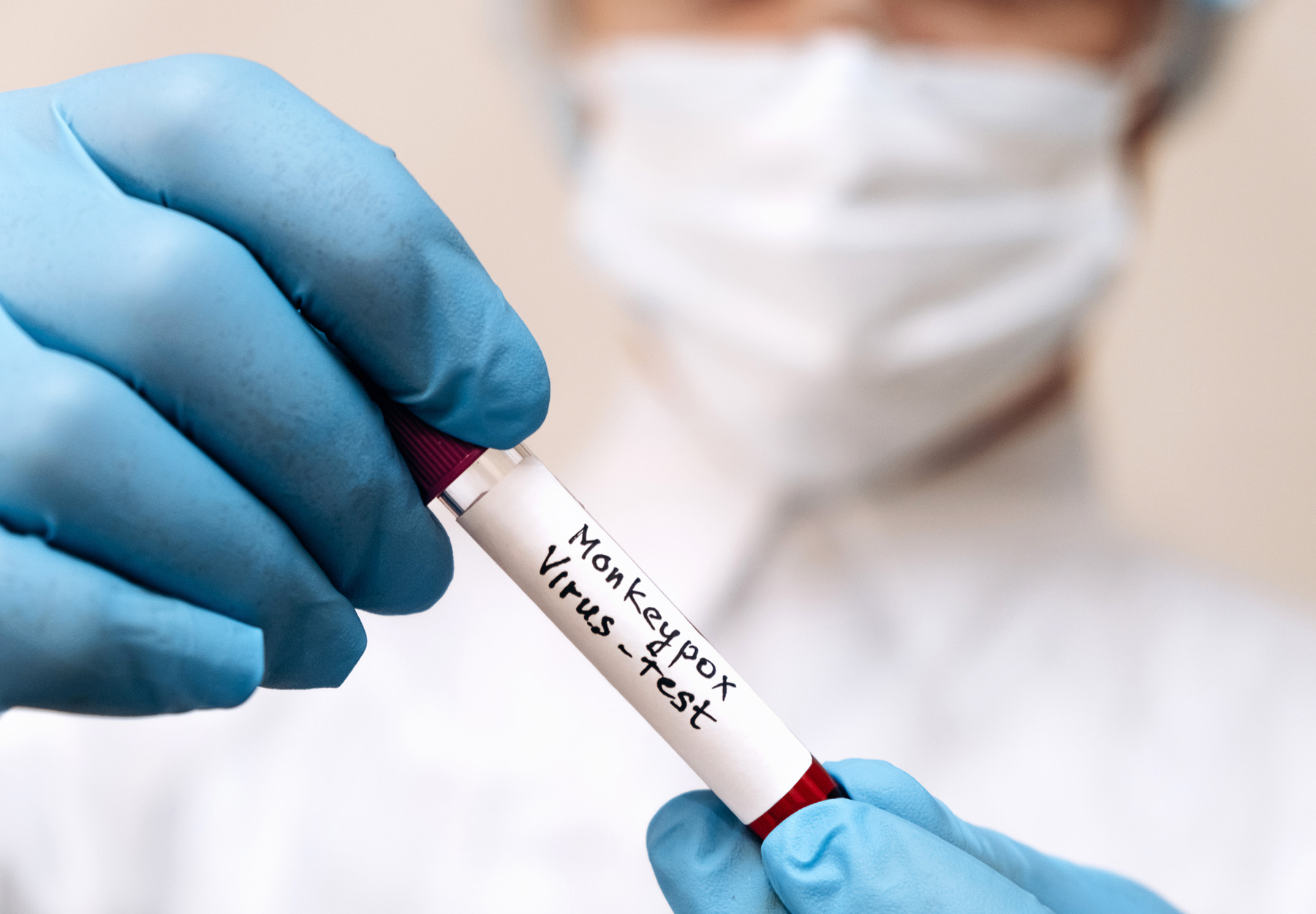 Closeup of healthcare worker in PPE holding up a blood test tube for a monkeypox test
