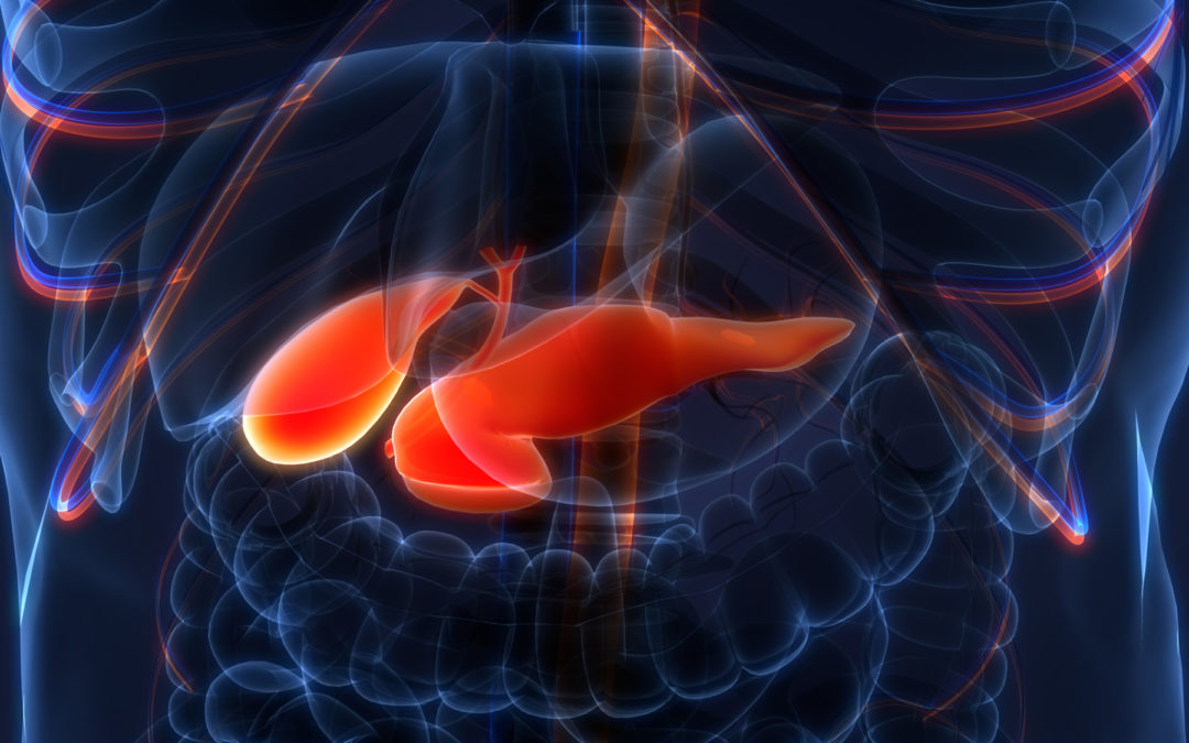 Pancreatic Cancer Is Caught Sooner When Regular Screening Done