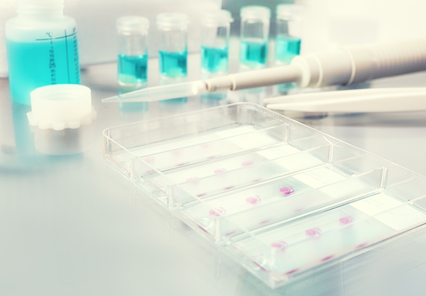 Closeup image of pathology slides with a pipette and tubes of teal-colored liquid in the background. Stock image.