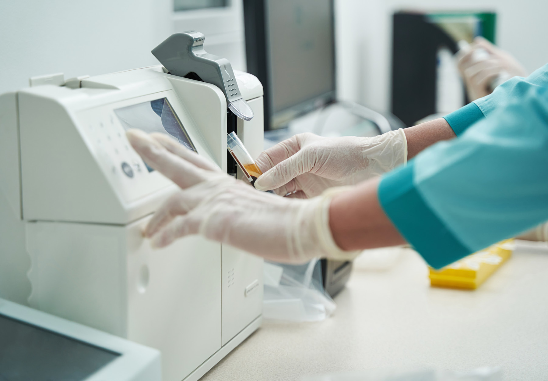 Closeup of lab employee's glove hand using a clinical lab machine. Stock photo.