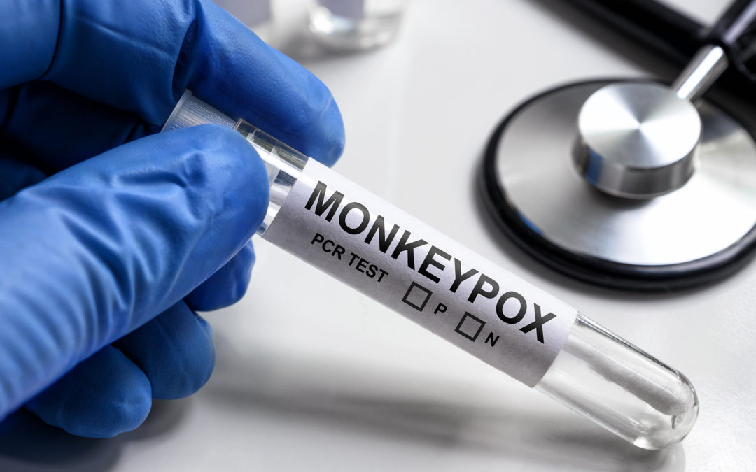 Inadequate Reimbursement Threatens Monkeypox Lab Testing Response
