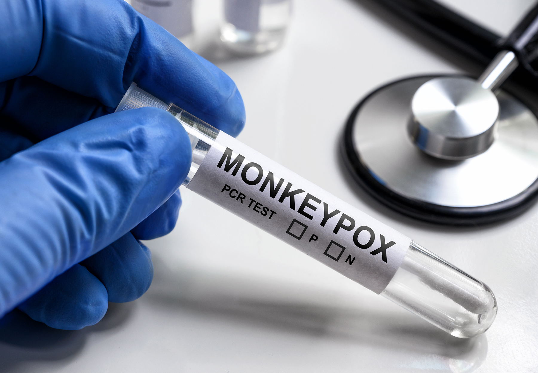 Image of gloved hand holding test tube with a monkey pox sample. Stock photo.