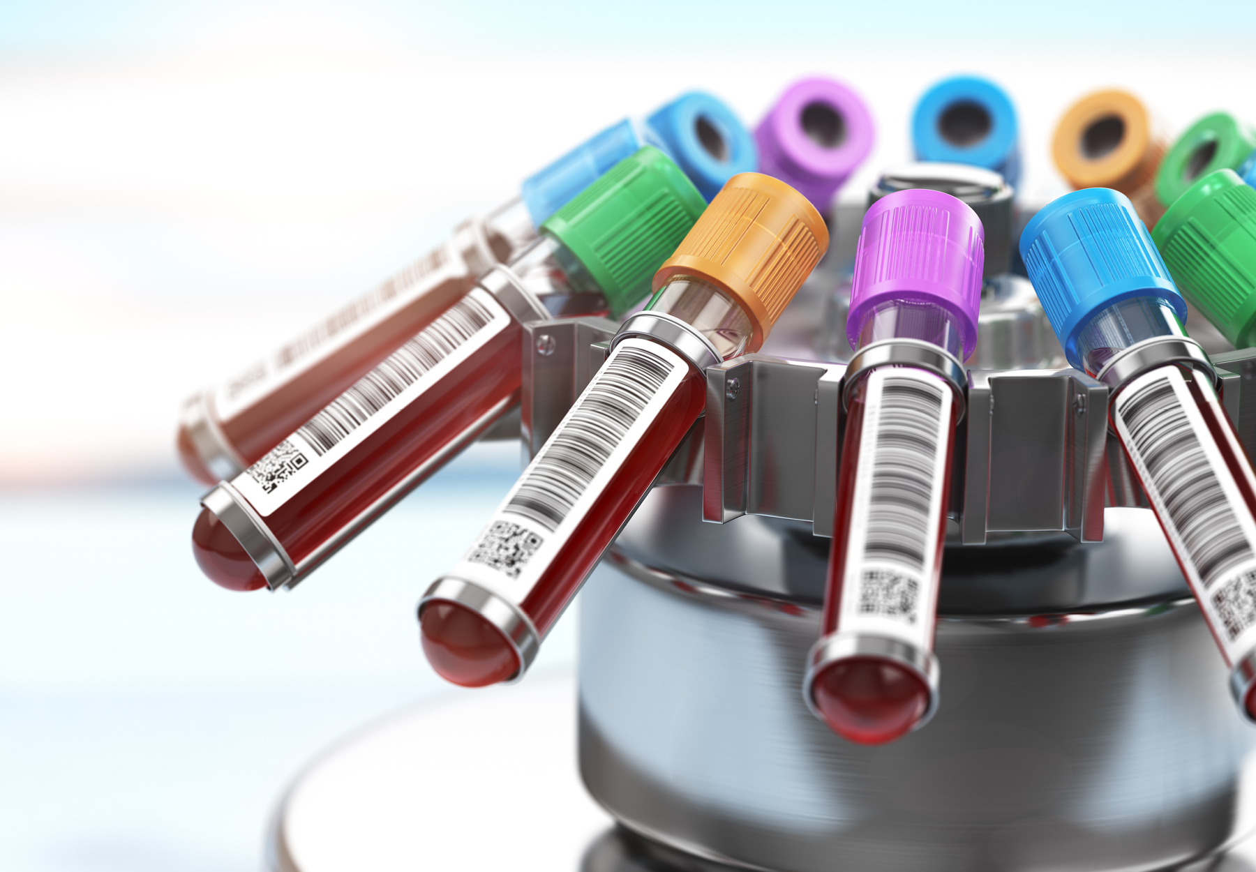 Test tubes of blood in a centrifuge rack in the lab. Stock photo.