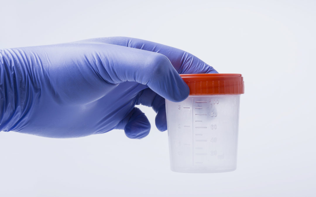 Clinical Lab Pays Big to Settle UDT False Claims Allegations in NC