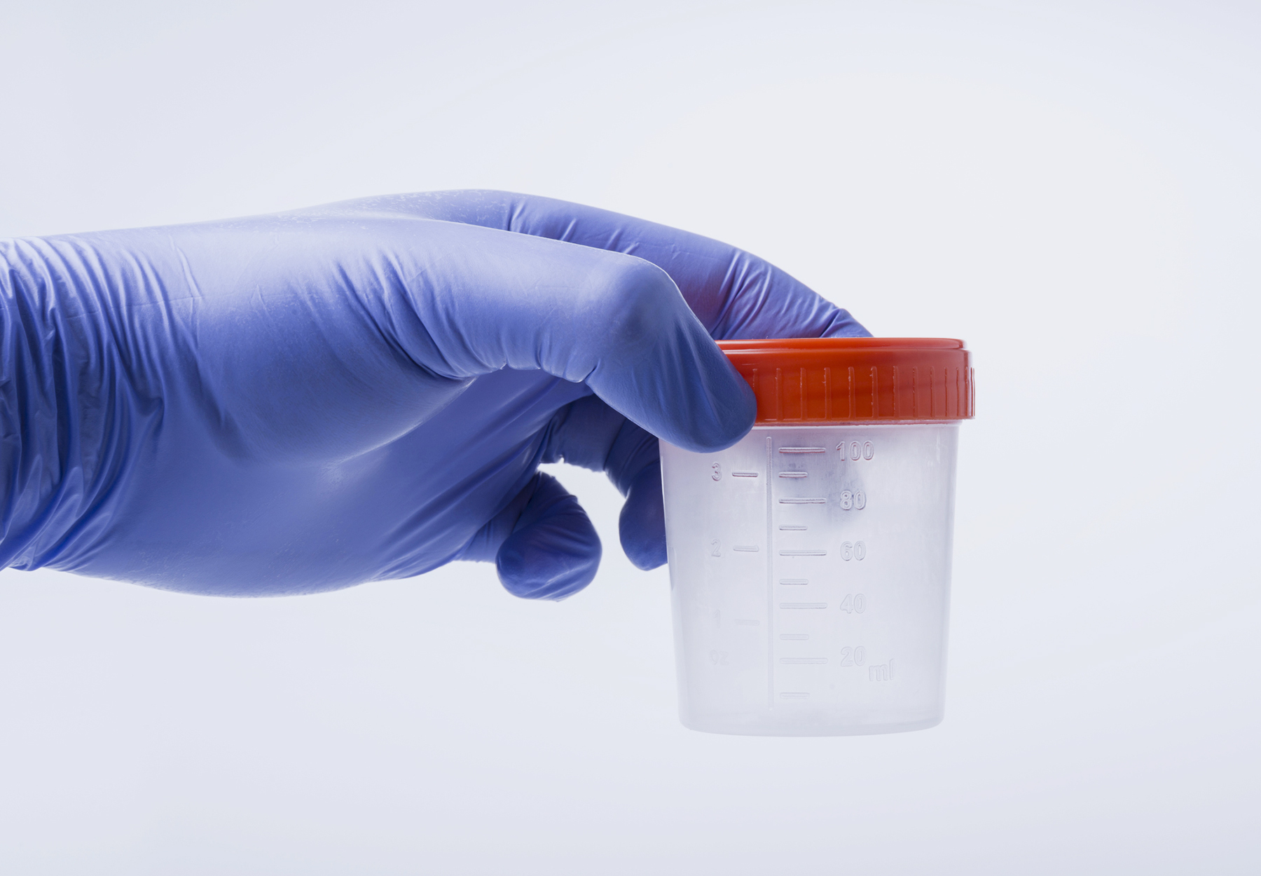 Hand wearing a purple medical glove holds an empty urine sample container. Stock image.