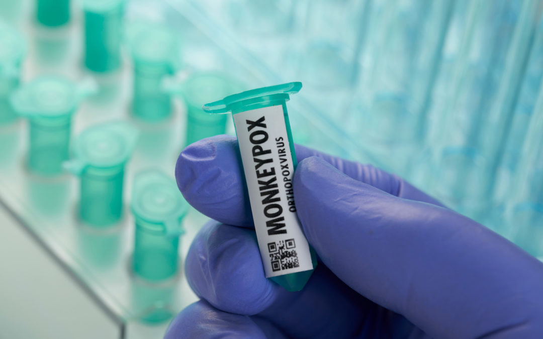 ACLA: Low Reimbursement Jeopardizes Monkeypox Lab Testing Effort