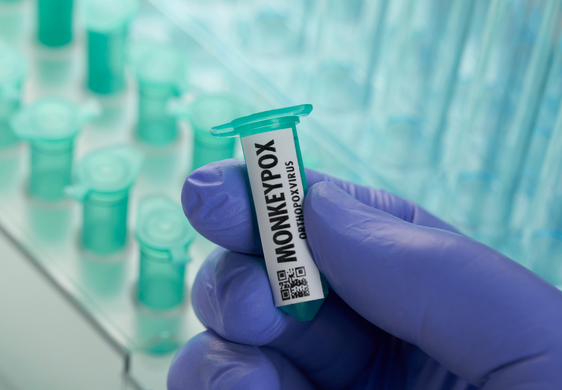 Gloved hand of lab worker holding an Eppendorf tube with monkeypox virus label. Stock image.