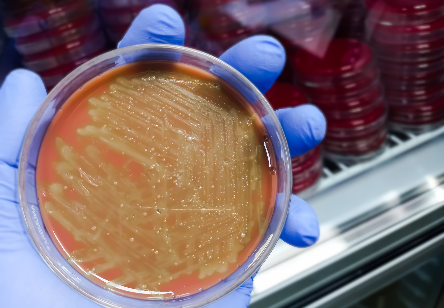 Gloved hand of lab worker holding an agar plate. Strep bacteria testing concept. iStock image.