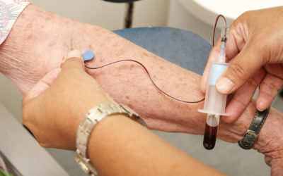 Which Blood Tests Are Best at Early Alzheimer’s Detection?