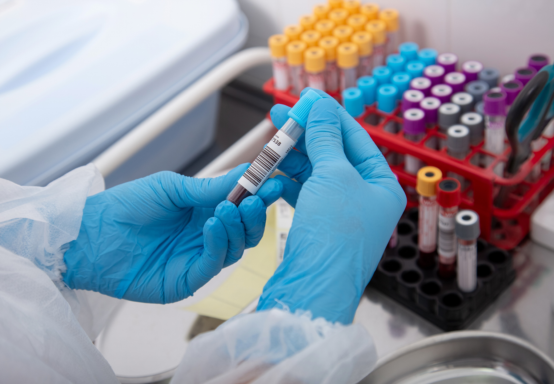 Hands with medical gloves holding blood sample iStock image