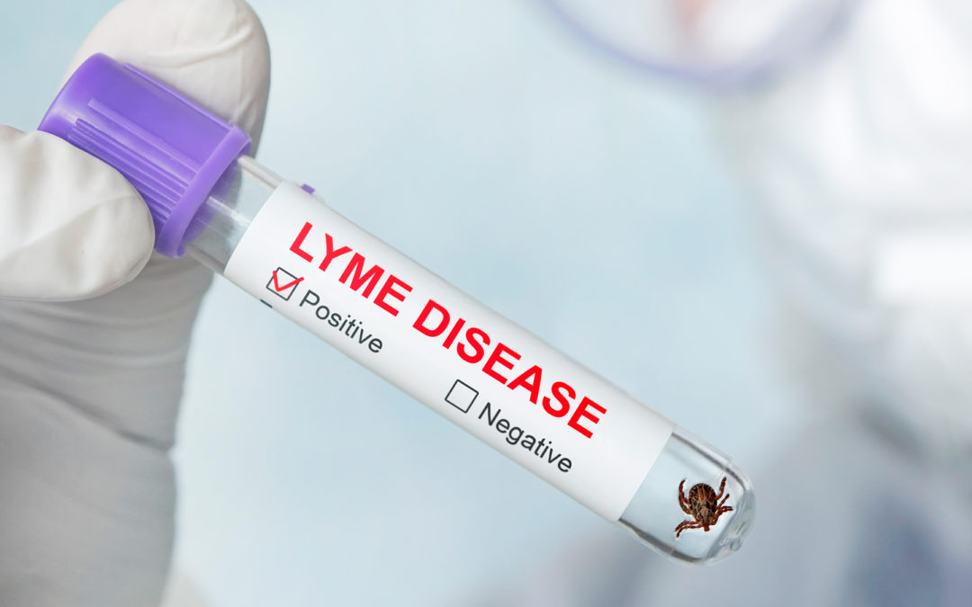 Recent Discovery Could Lead to a Better Lyme Disease Test