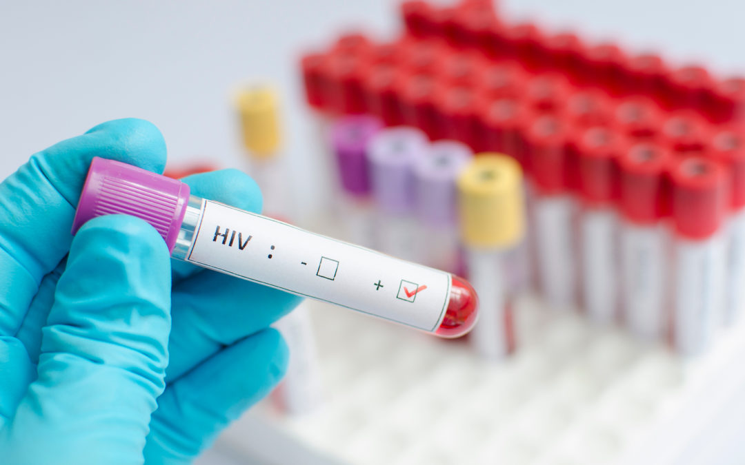 Early in Pandemic, HIV Testing Dropped Sharply, but Quickly Rebounded