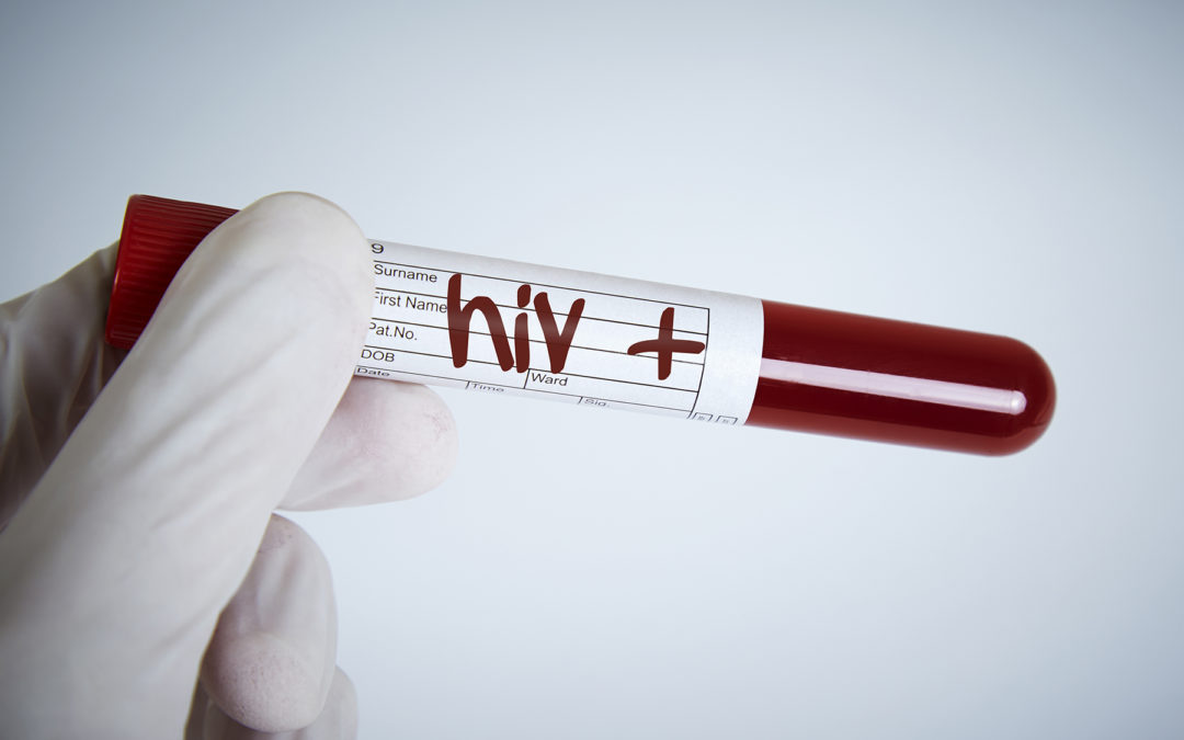 Developing an Automated HIV Self-Test for Use in Developing Countries