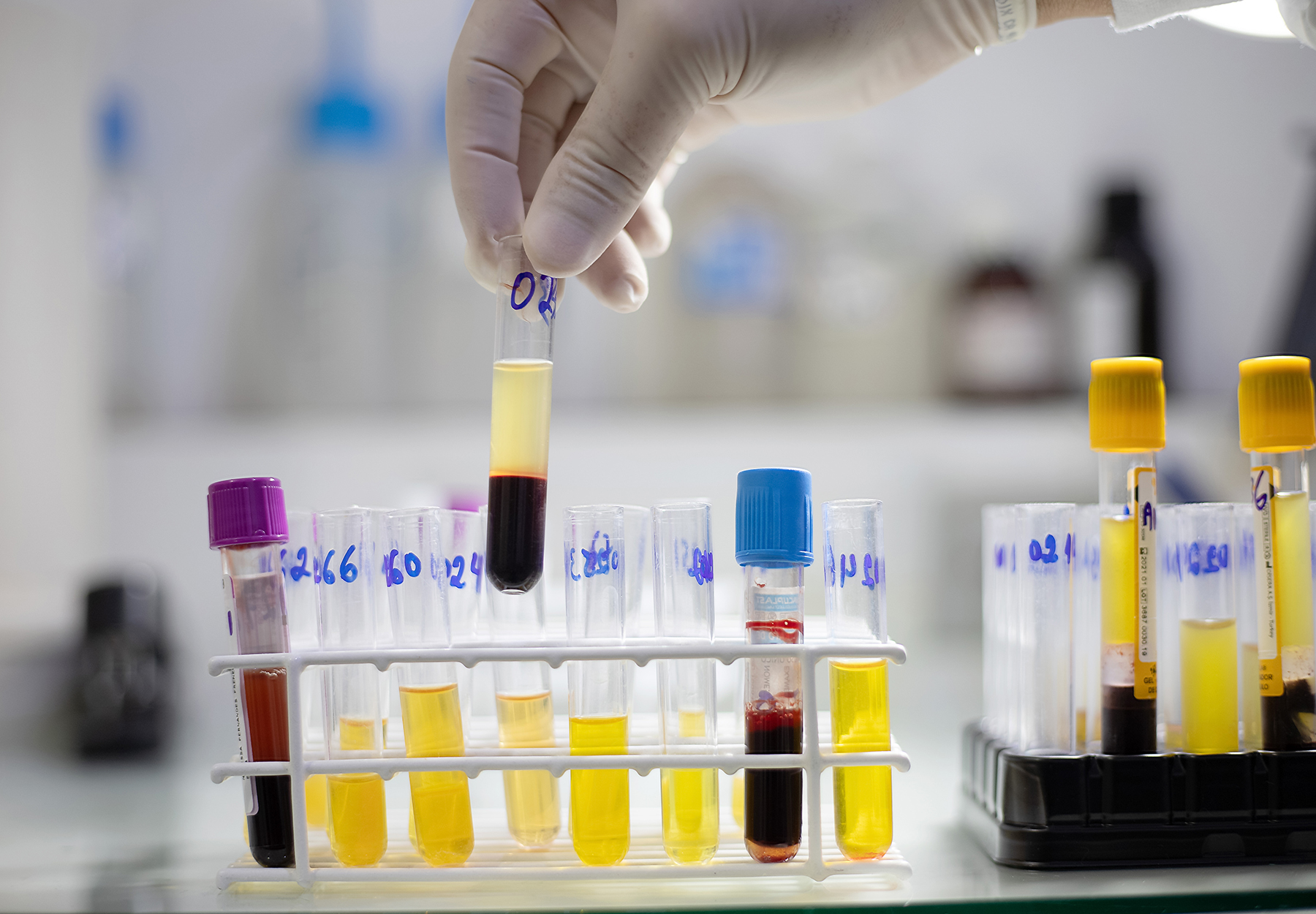 Closeup of the gloved hand of a laboratory professional lifting a test tube of blood from a rack. iStock image.