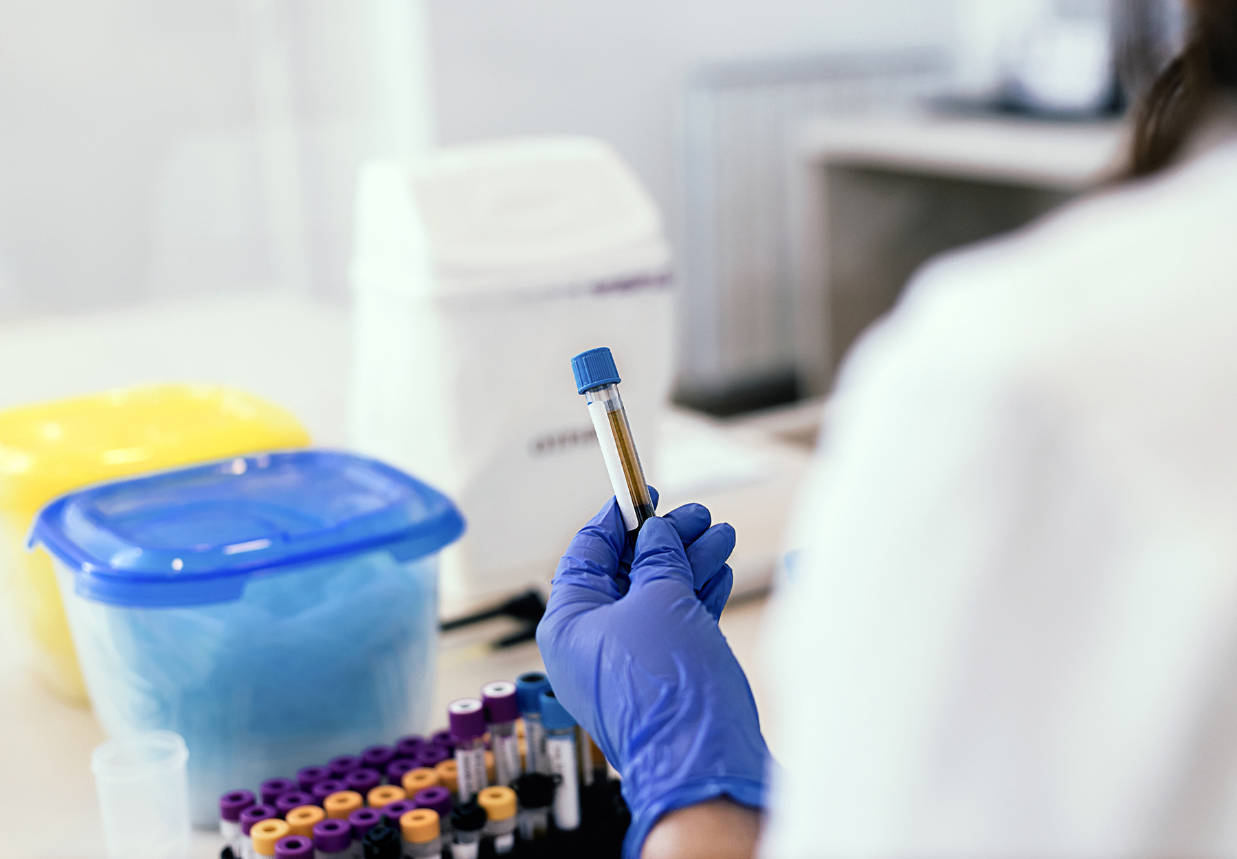 Medical Equipment. Closeup of a Scientist Working With Blood Samples in Lab. Science, Chemistry, Biology, Medicine and People Concept. Scientist Working With Blood Sample in Laboratory