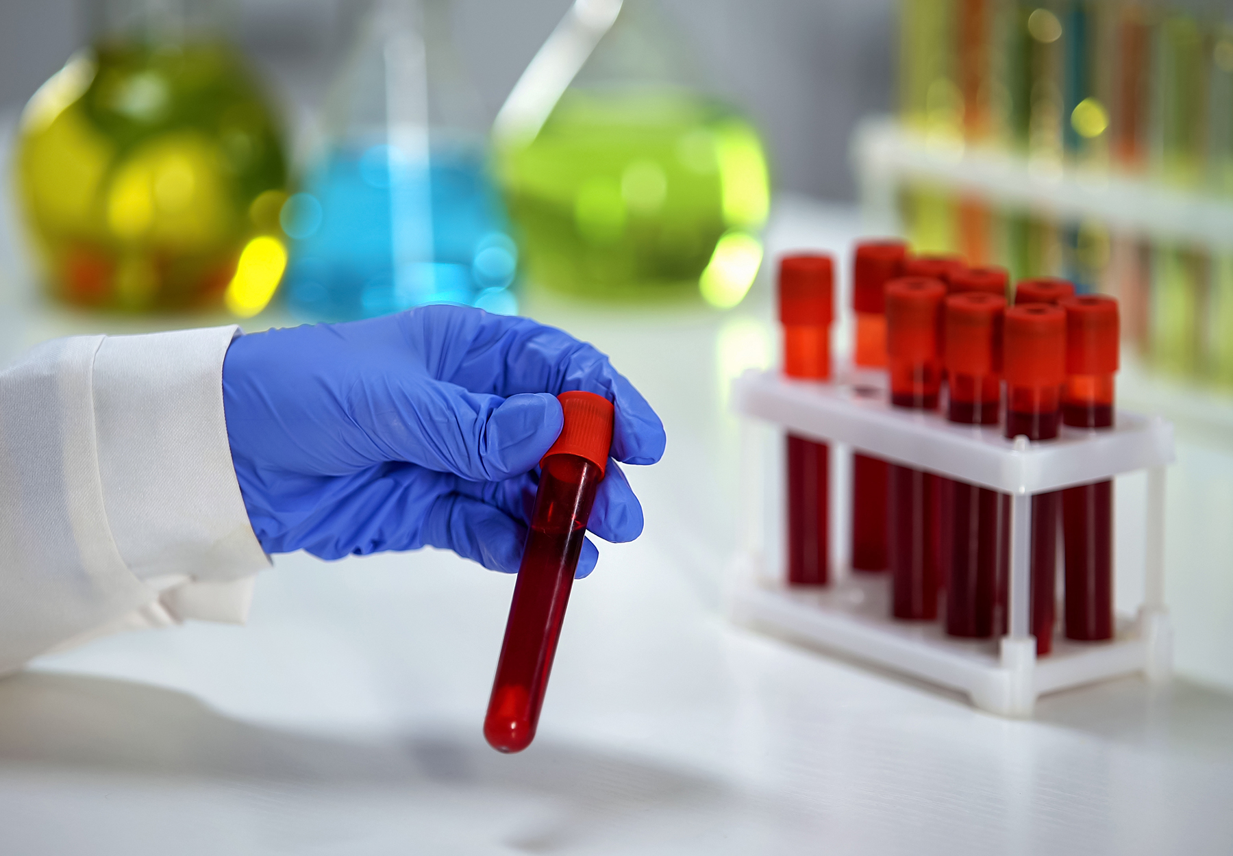 Closeup of the gloved hand of a lab professional holding a blood sample near a rack of other blood samples. Blood testing concept.
