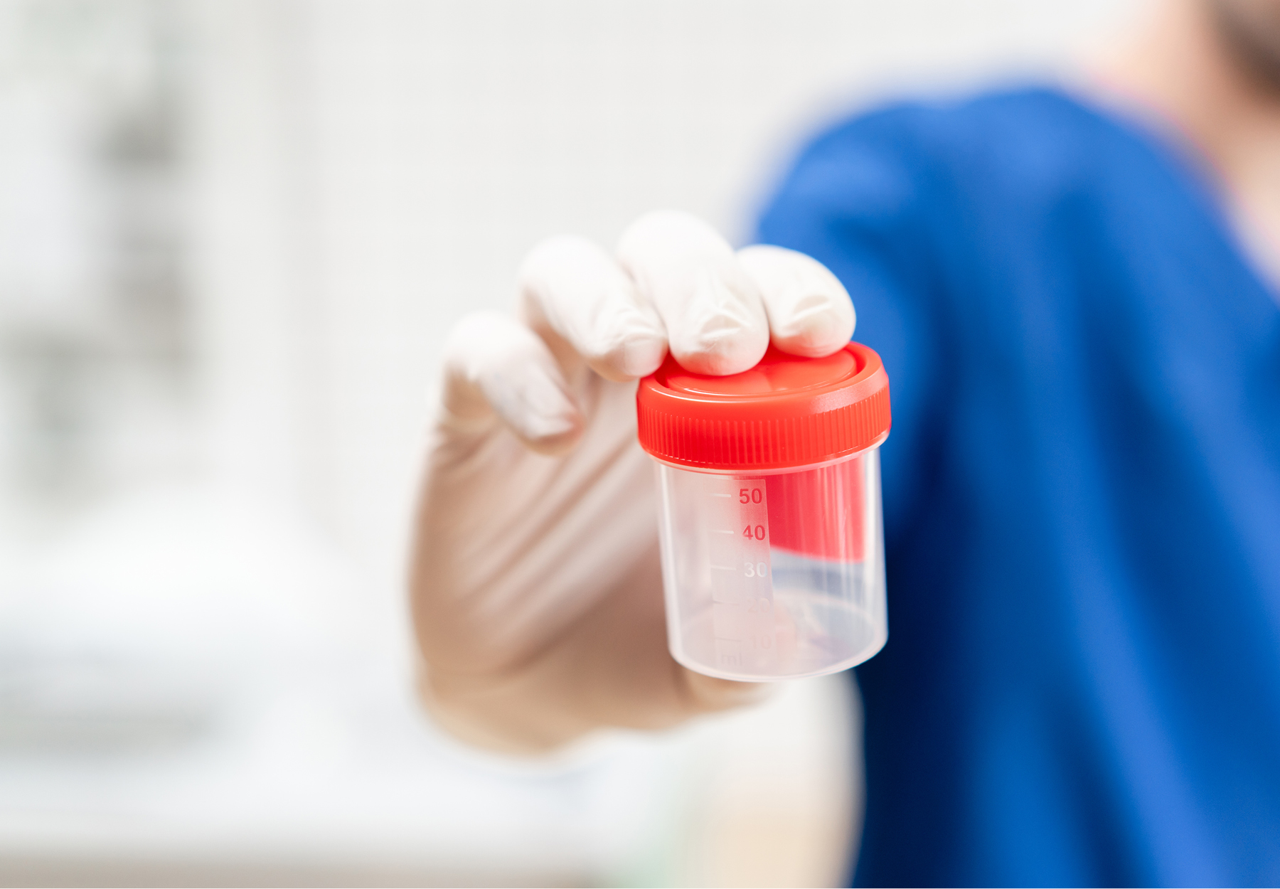 Closeup of medical professional in blue scrubs and white gloves holding out an empty urine sample container. iStock image.