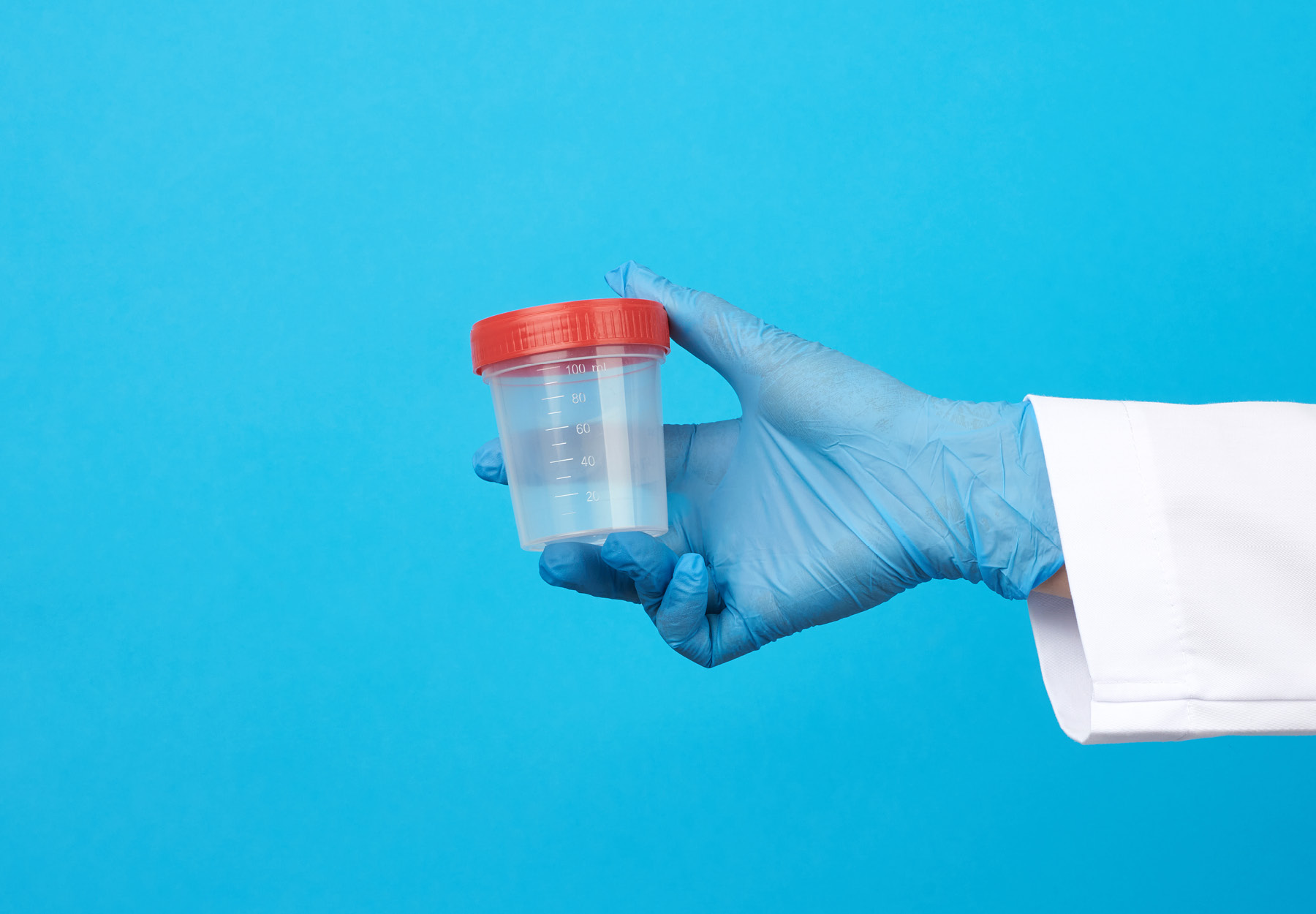 doctor in a white coat holds a empty plastic container for urine specimen, wearing blue sterile medical gloves