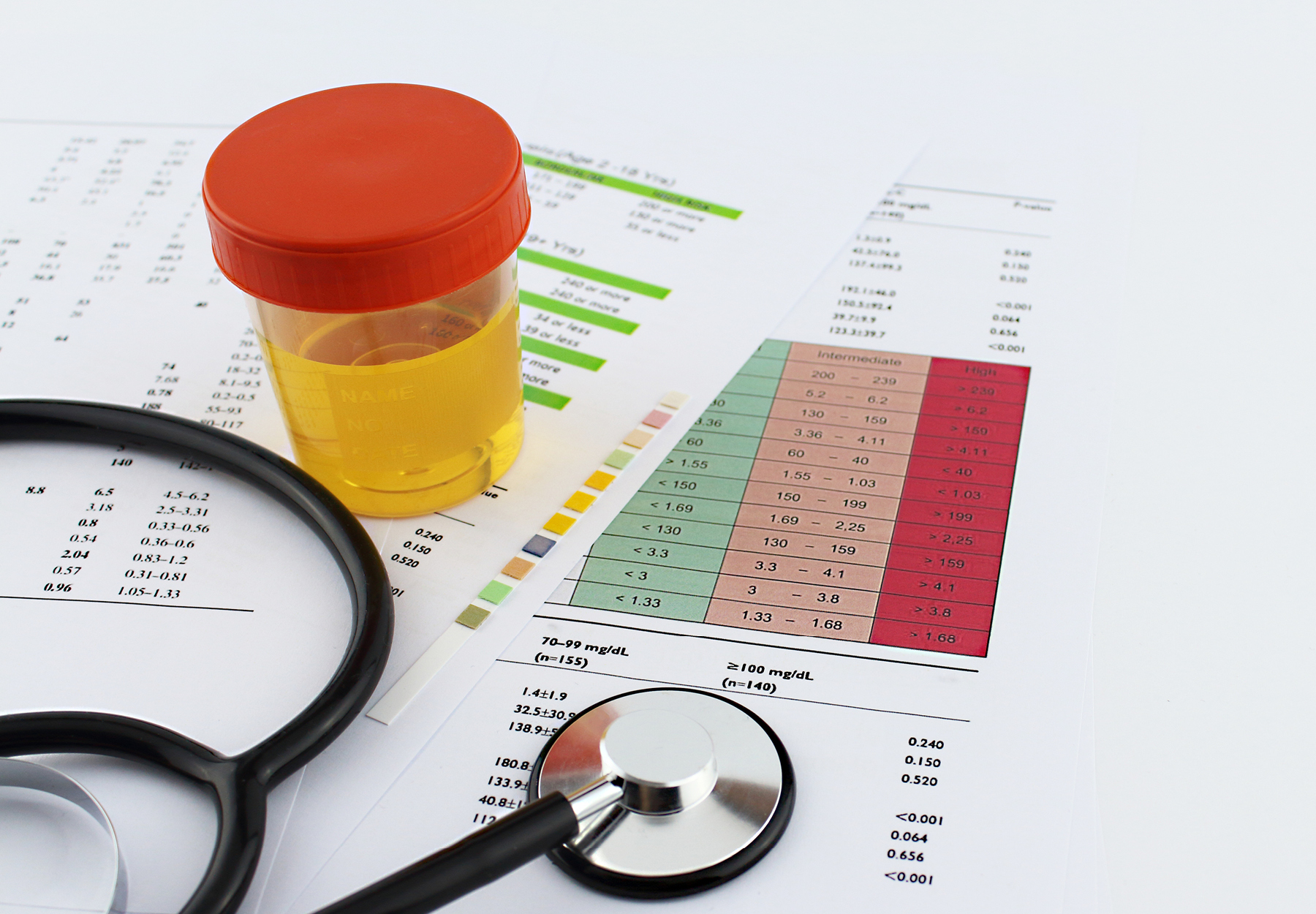 Closeup of urine sample in container near stethoscope and paperwork on table. iStock image.