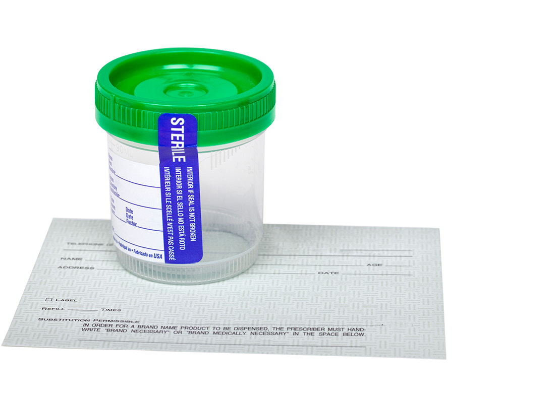 Empty urine sample container and form for drug test for prescription drugs. Stock image. Drug testing/toxicology concept.