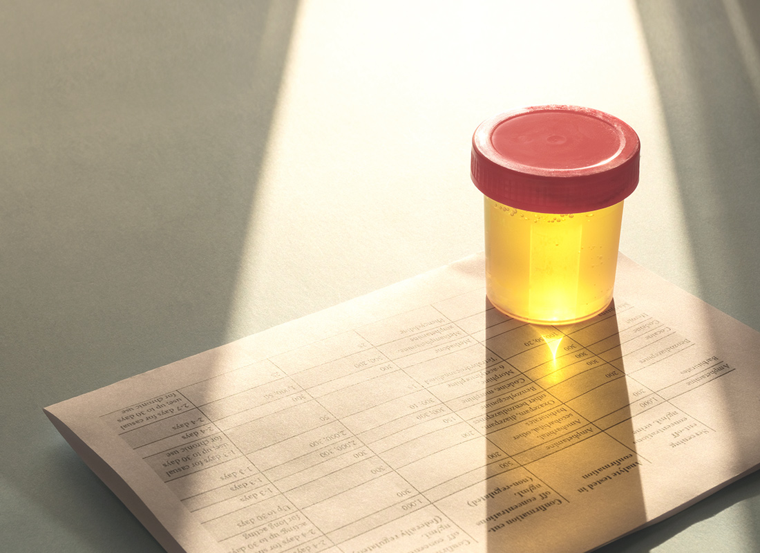 Urine sample in container on table with paperwork for urine testing. Stock image. Urine drug testing concept.