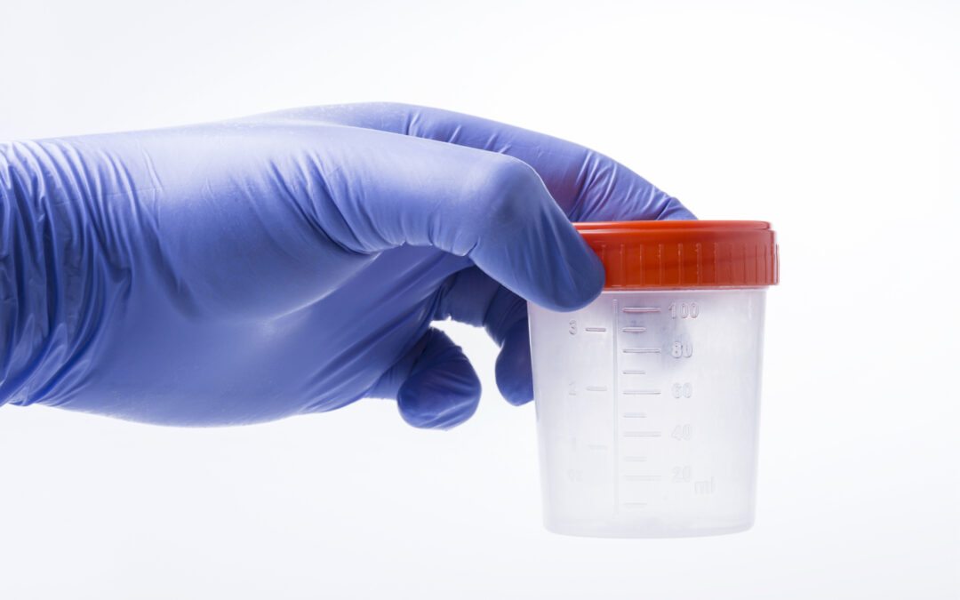 Enforcement Trends: The Urine Drug Testing Crackdown and Three Ways to Avoid It
