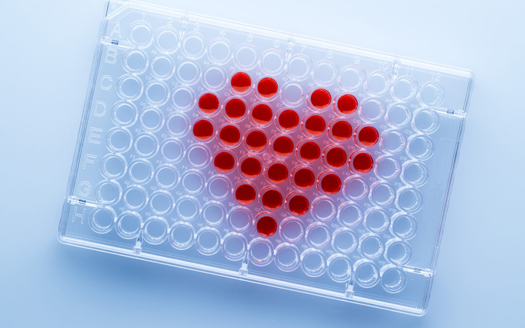 Polygenic Risk Scores: A Cardiovascular Conundrum