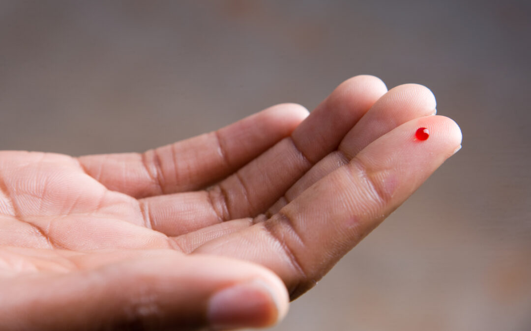 FDA Watch: New BD Collection System Uses Just Tiny Amounts of Blood