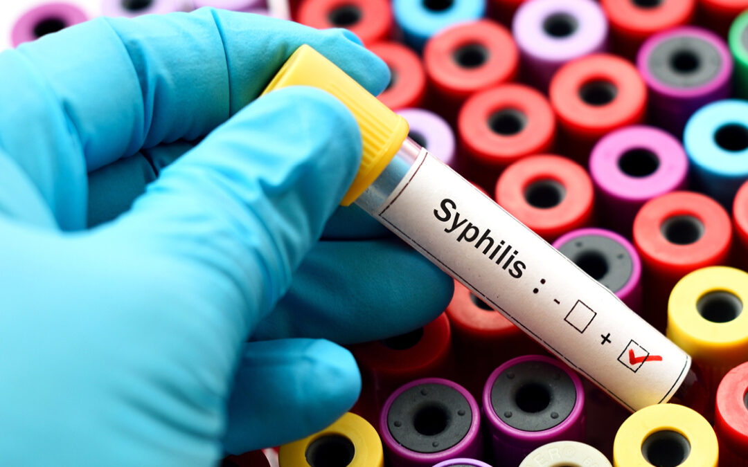 CDC Releases Recommendations to Address Rising Syphilis Cases