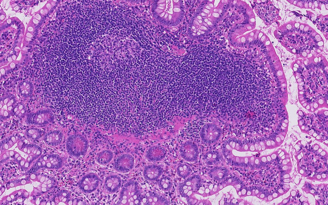The Demand for Digital Pathology