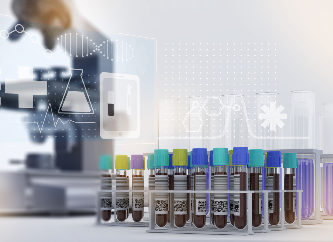 A photographic representation of laboratory testing, featuring a variety of blood sample tubes in the foreground and test tubes, medical symbols, and a microscope in the background.
