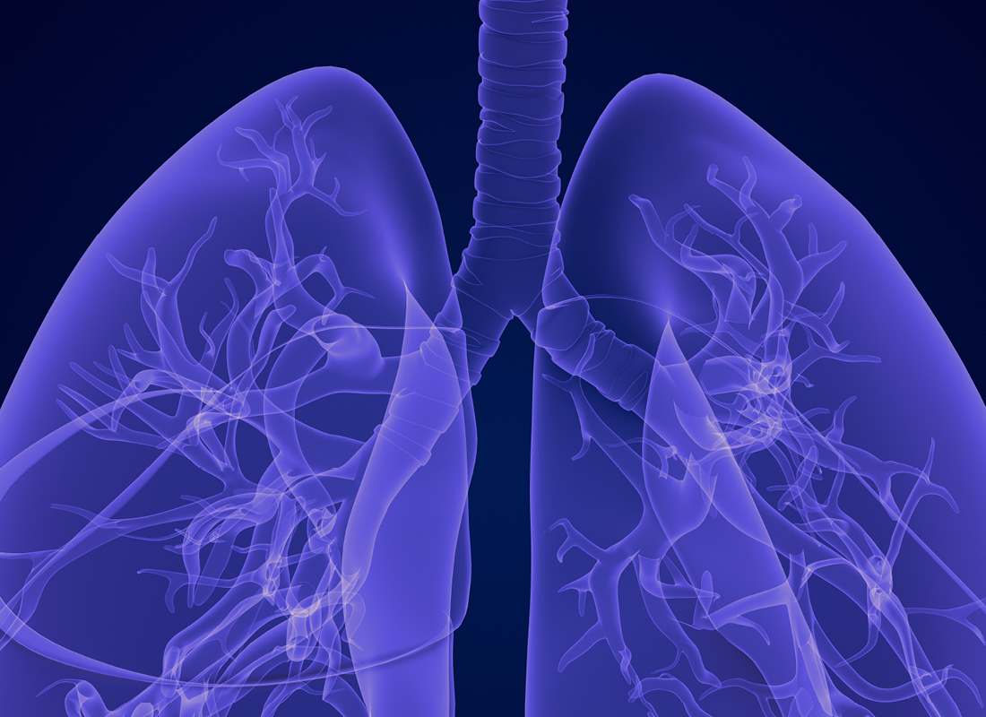 Savara is now marketing a blood test to detect aPAP, a rare lung condition.