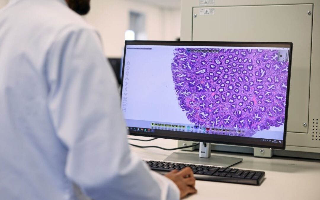 Success of Digital Pathology May Come Through its Ability to Handle Volumes
