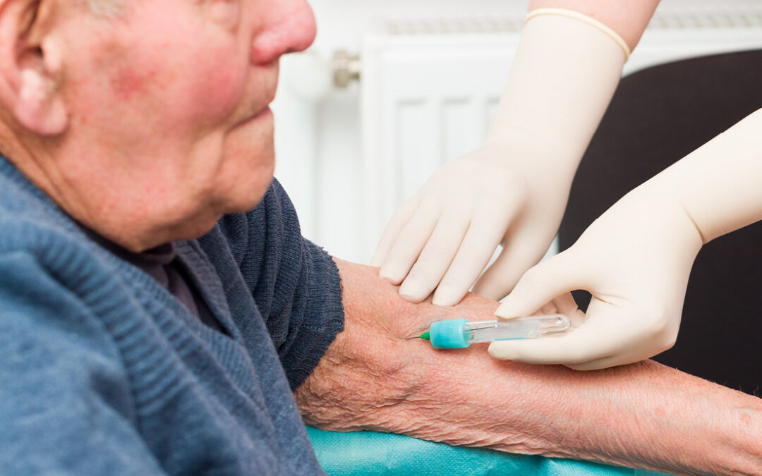 National Lab Companies Move Quickly to Market Fujirebio’s Lumipulse for Earlier Alzheimer’s Detection