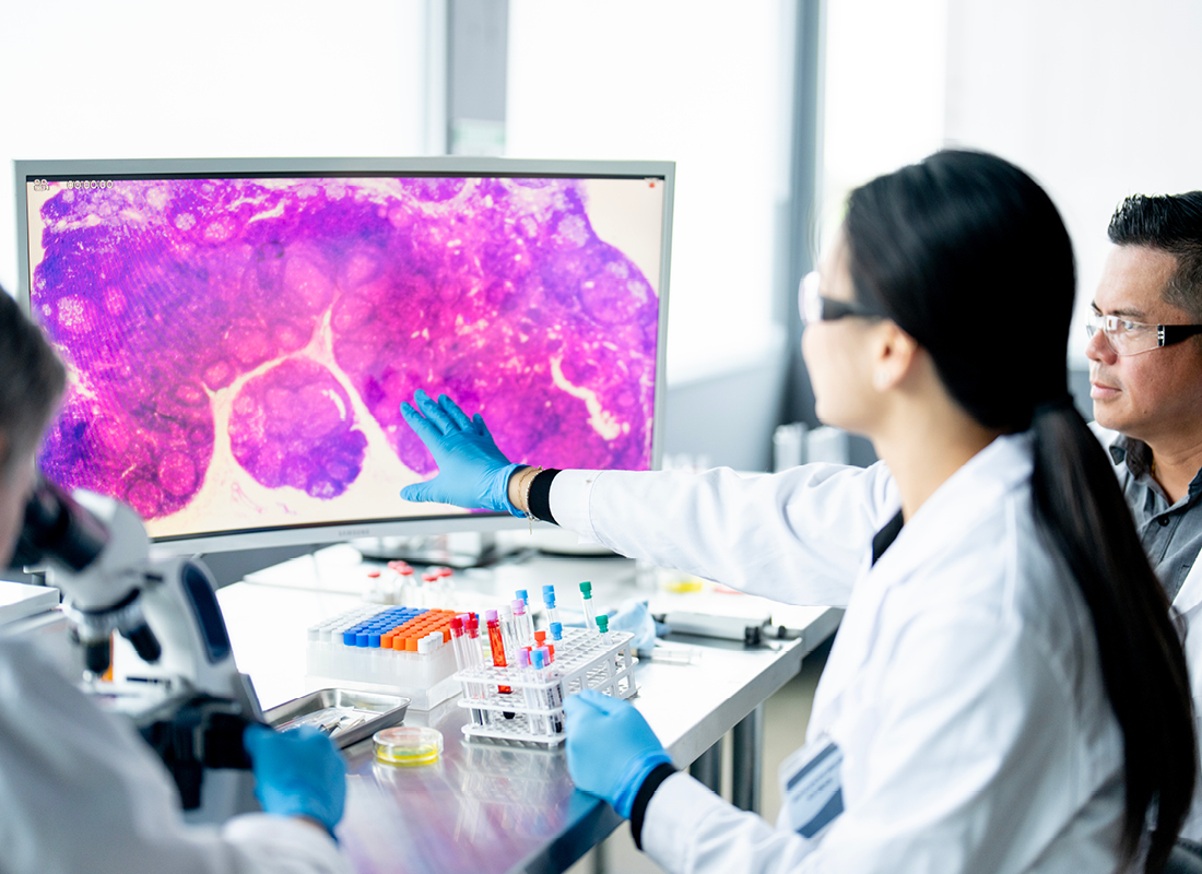 New AI model predicts genetic alterations in colorectal cancer